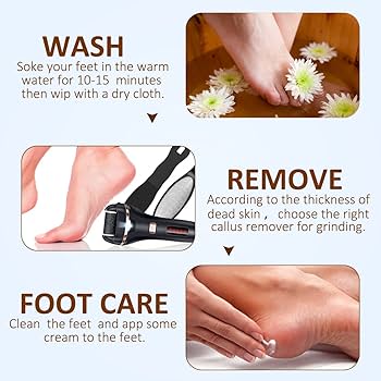 フットケア Electric Callus Remover Amazon.com : Electric Callus Remover for Feet with Vacuum